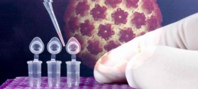使用 Digene 测试进行 HPV 诊断
